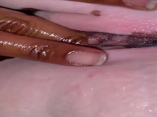 Liyah da bunni &lpar; vitiligo modelis &rpar; trunka bjaurybė nuo stretch3x
